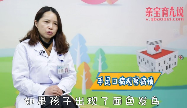 手足口病如何观察病情?