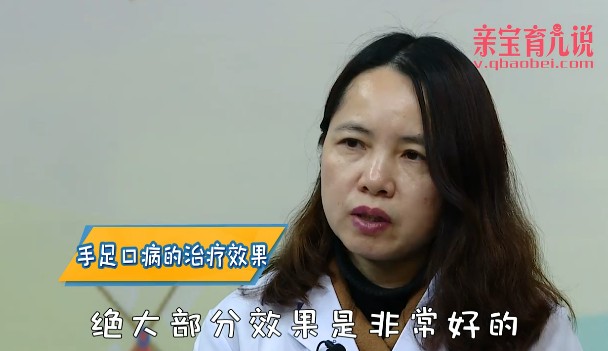 手足口病治疗效果怎样？
